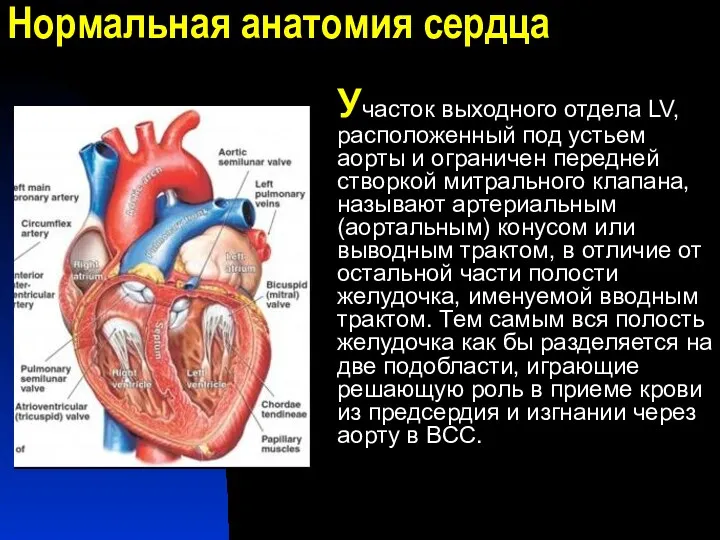 Нормальная анатомия сердца Участок выходного отдела LV, расположенный под устьем