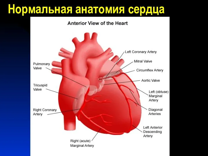 Нормальная анатомия сердца