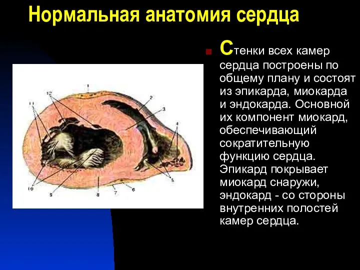 Нормальная анатомия сердца Стенки всех камер сердца построены по общему