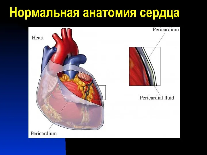 Нормальная анатомия сердца