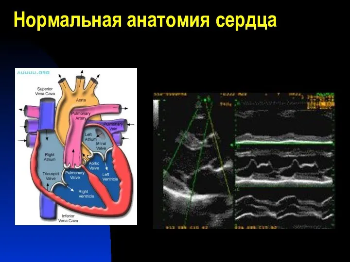 Нормальная анатомия сердца