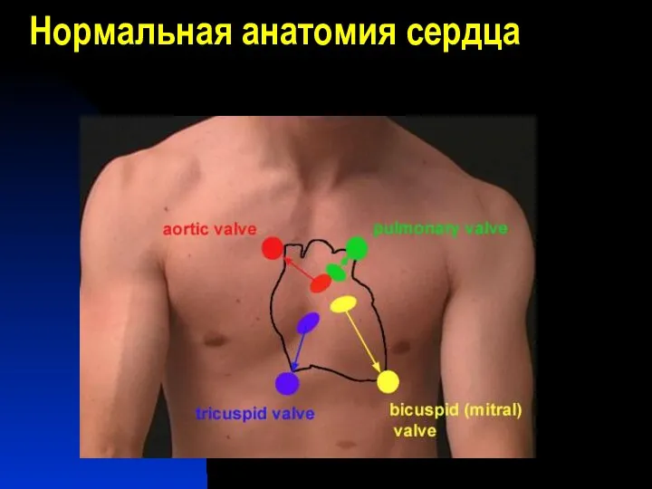 Нормальная анатомия сердца