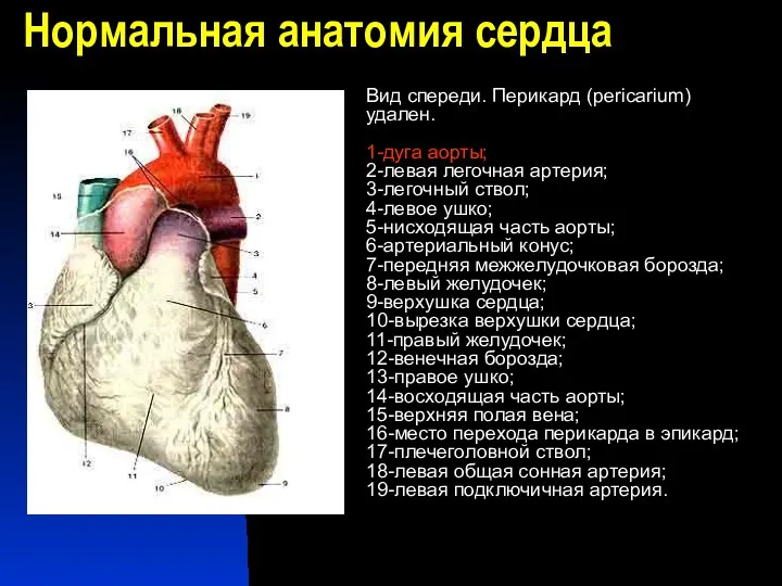 Нормальная анатомия сердца Вид спереди. Перикард (pericarium) удален. 1-дуга аорты;