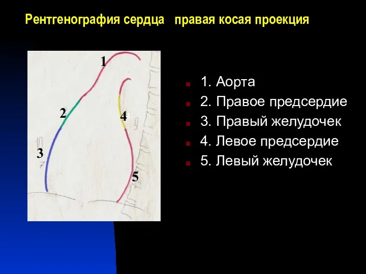 Рентгенография сердца правая косая проекция 1. Аорта 2. Правое предсердие