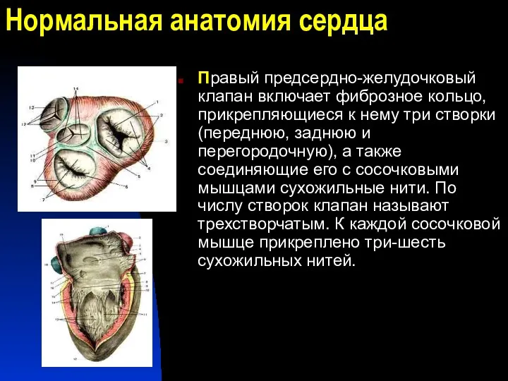 Нормальная анатомия сердца Правый предсердно-желудочковый клапан включает фиброзное кольцо, прикрепляющиеся