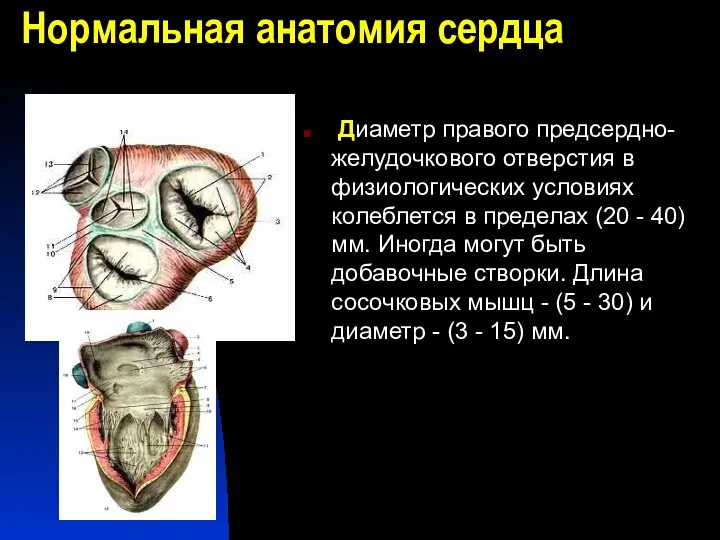 Нормальная анатомия сердца Диаметр правого предсердно-желудочкового отверстия в физиологических условиях