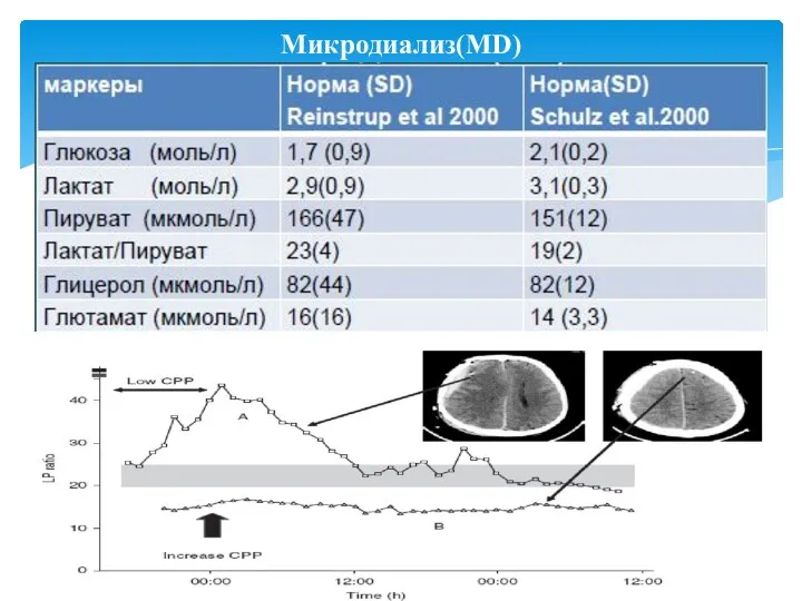 Микродиализ(MD)