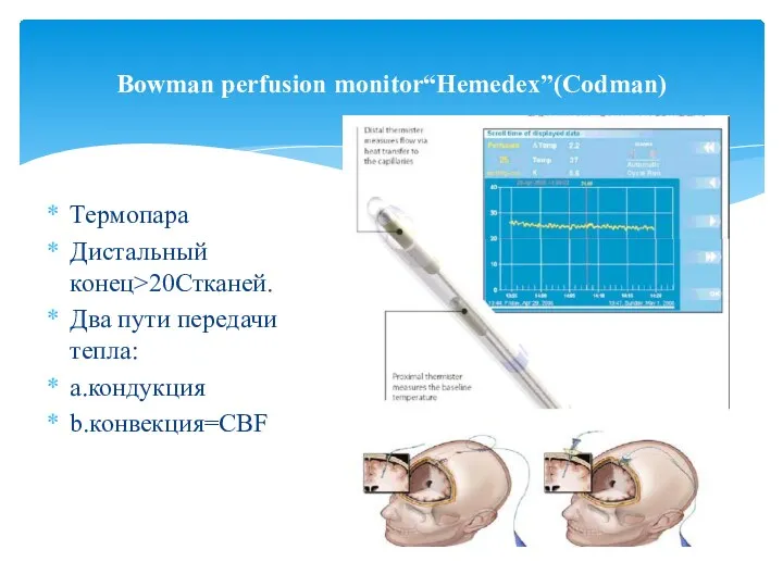 Термопара Дистальный конец>20Cтканей. Два пути передачи тепла: a.кондукция b.конвекция=CBF Bowman perfusion monitor“Hemedex”(Codman)