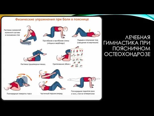 ЛЕЧЕБНАЯ ГИМНАСТИКА ПРИ ПОЯСНИЧНОМ ОСТЕОХОНДРОЗЕ