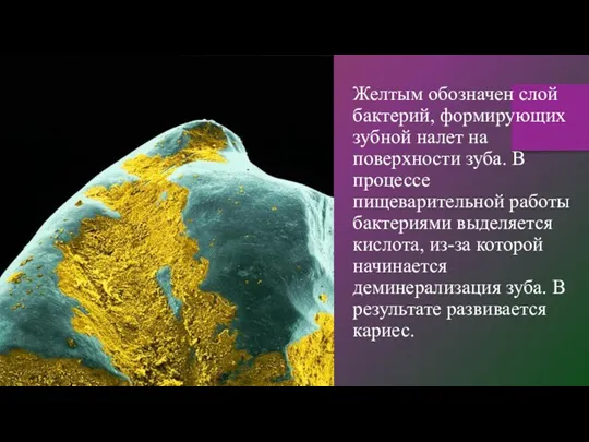 Желтым обозначен слой бактерий, формирующих зубной налет на поверхности зуба.