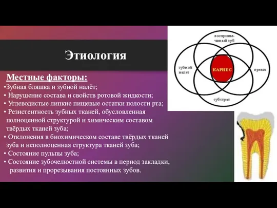 Этиология Местные факторы: Зубная бляшка и зубной налёт; Нарушение состава