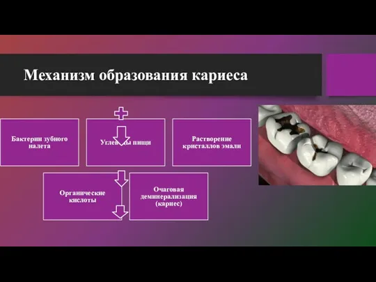 Механизм образования кариеса Бактерии зубного налета Углеводы пищи Растворение кристаллов эмали Органические кислоты Очаговая деминерализация (кариес)