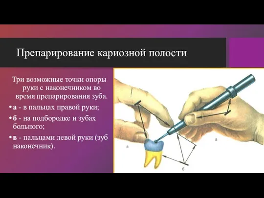 Препарирование кариозной полости Три возможные точки опоры руки с наконечником