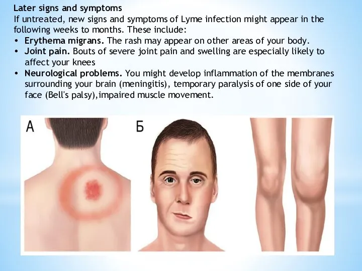 Later signs and symptoms If untreated, new signs and symptoms