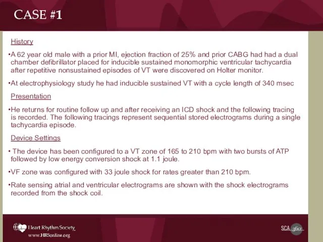 History A 62 year old male with a prior MI,