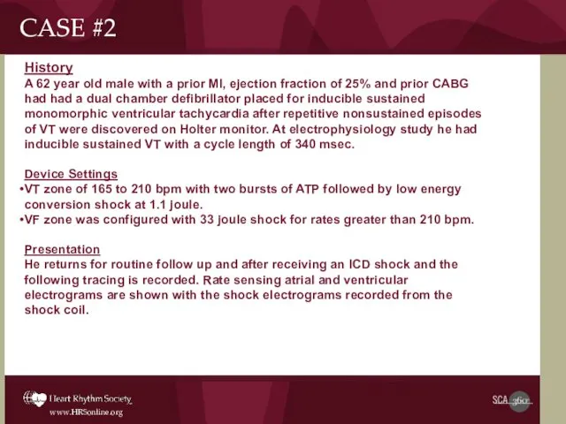 History A 62 year old male with a prior MI,