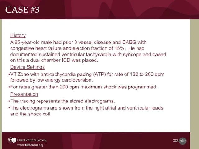 CASE #3 History A 65-year-old male had prior 3 vessel