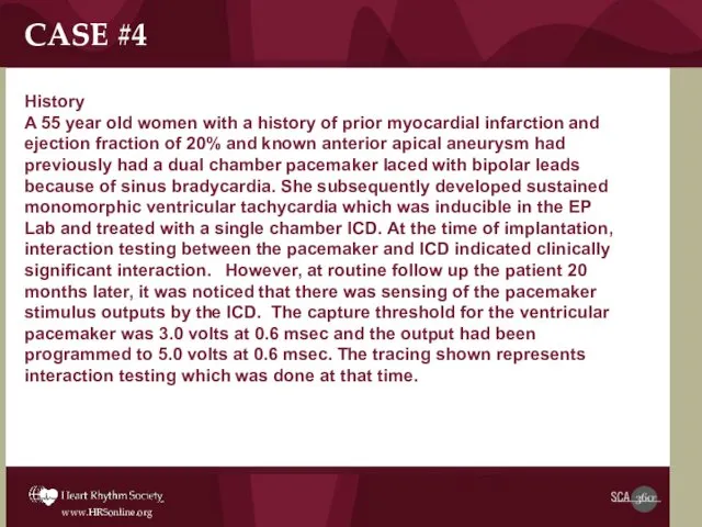 CASE #4 History A 55 year old women with a