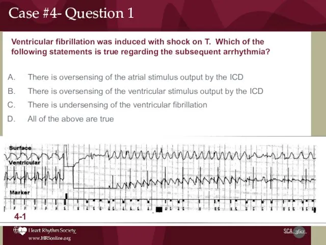 Ventricular fibrillation was induced with shock on T. Which of