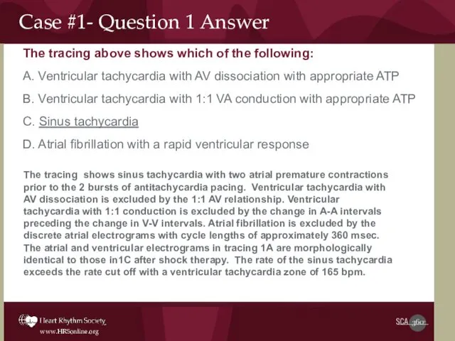 Case #1- Question 1 Answer The tracing above shows which