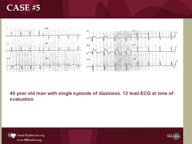 40 year old man with single episode of dizziness. 12