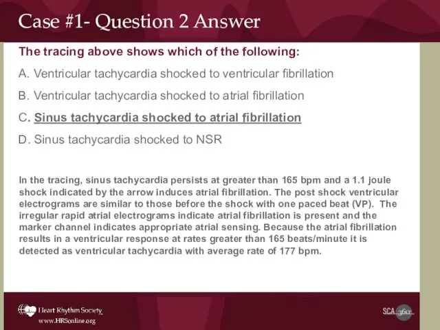 Case #1- Question 2 Answer The tracing above shows which