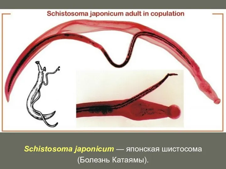 Schistosoma japonicum — японская шистосома (Болезнь Катаямы).