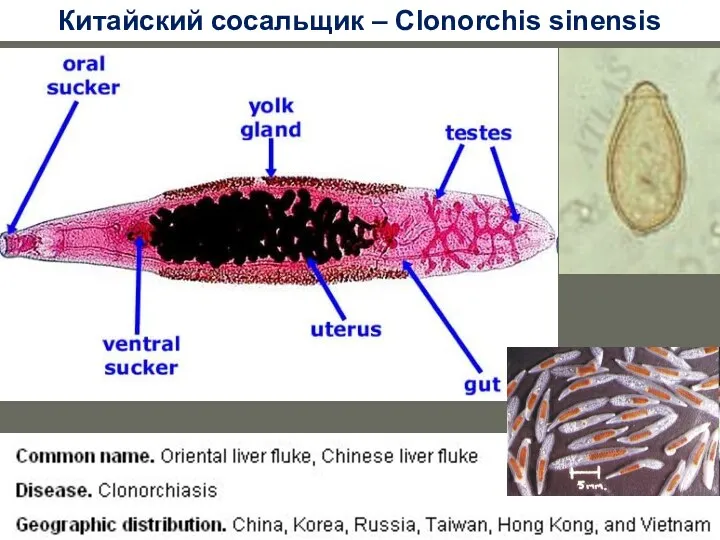 Clonorchis sinensis Китайский сосальщик – Clonorchis sinensis