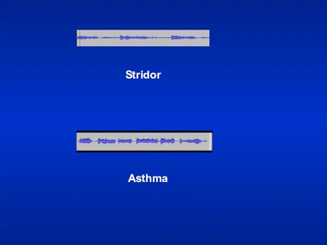 Stridor Asthma