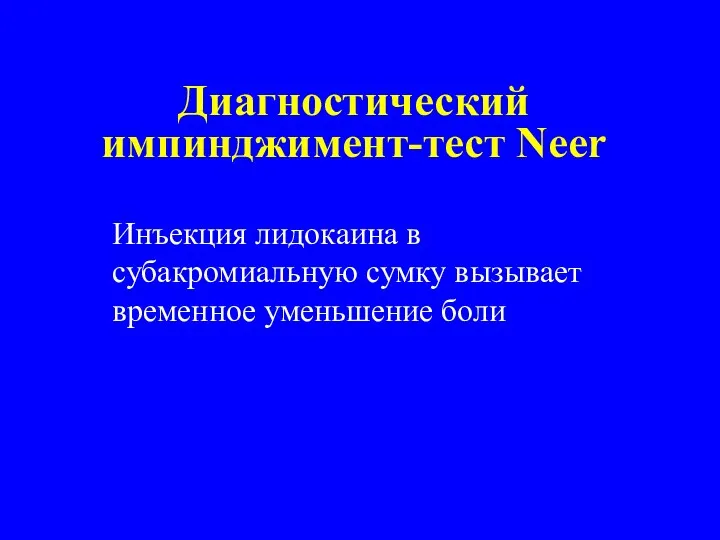 Диагностический импинджимент-тест Neer Инъекция лидокаина в субакромиальную сумку вызывает временное уменьшение боли