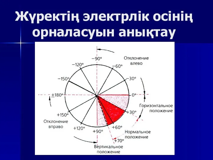 Жүректің электрлік осінің орналасуын анықтау