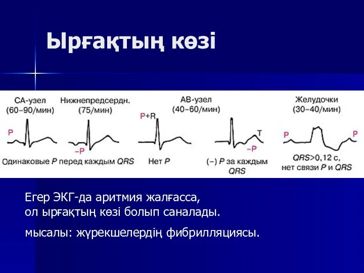 Ырғақтың көзі Егер ЭКГ-да аритмия жалғасса, ол ырғақтың көзі болып саналады. мысалы: жүрекшелердің фибрилляциясы.