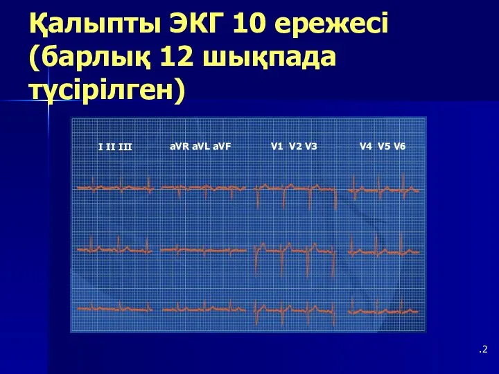 Қалыпты ЭКГ 10 ережесі (барлық 12 шықпада түсірілген) .2