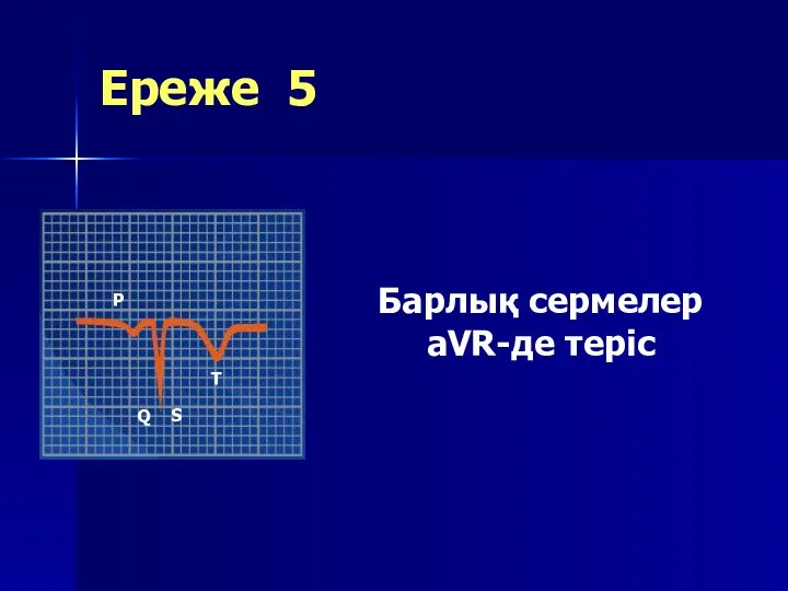 Ереже 5 Барлық сермелер aVR-де теріс