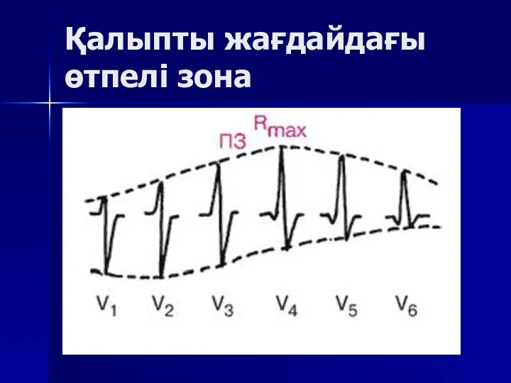 Қалыпты жағдайдағы өтпелі зона