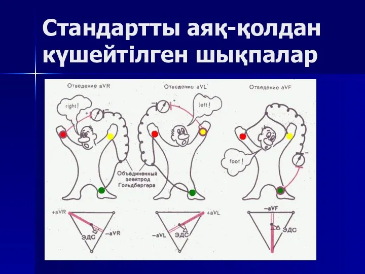 Стандартты аяқ-қолдан күшейтілген шықпалар