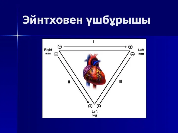 Эйнтховен үшбұрышы