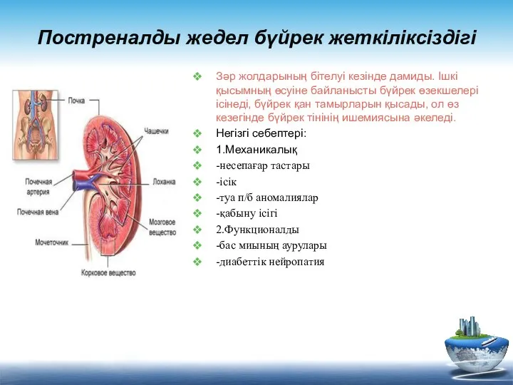 Постреналды жедел бүйрек жеткіліксіздігі Зәр жолдарының бітелуі кезінде дамиды. Ішкі