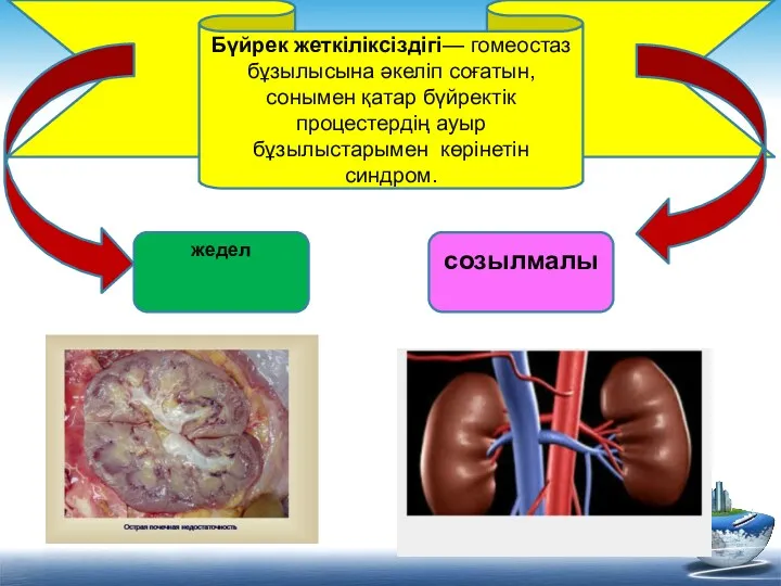 Бүйрек жеткіліксіздігі— гомеостаз бұзылысына әкеліп соғатын,сонымен қатар бүйректік процестердің ауыр бұзылыстарымен көрінетін синдром. жедел созылмалы
