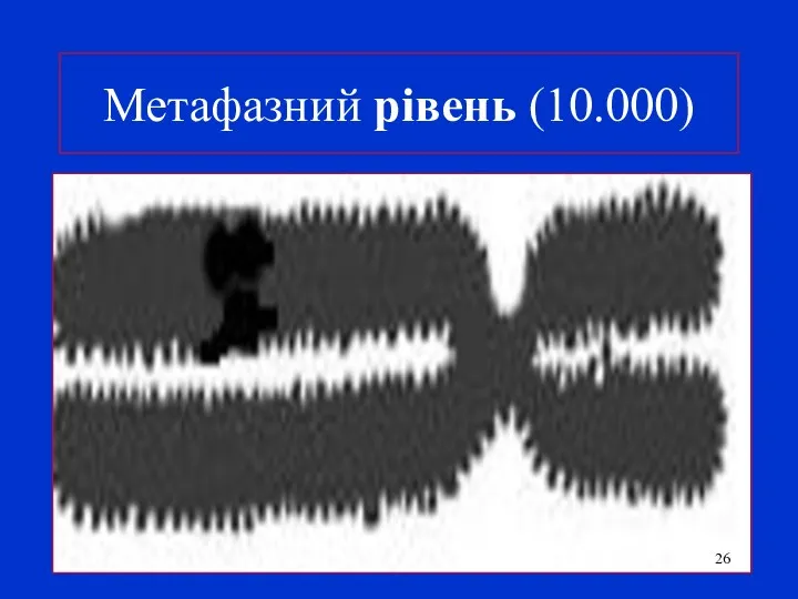 Метафазний рівень (10.000)