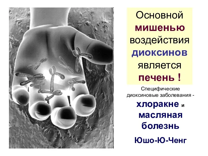 Основной мишенью воздействия диоксинов является печень ! Специфические диоксиновые заболевания - хлоракне и масляная болезнь Юшо-Ю-Ченг