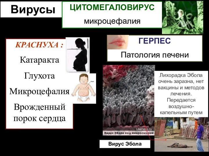 Вирусы КРАСНУХА : Катаракта Глухота Микроцефалия Врожденный порок сердца ЦИТОМЕГАЛОВИРУС