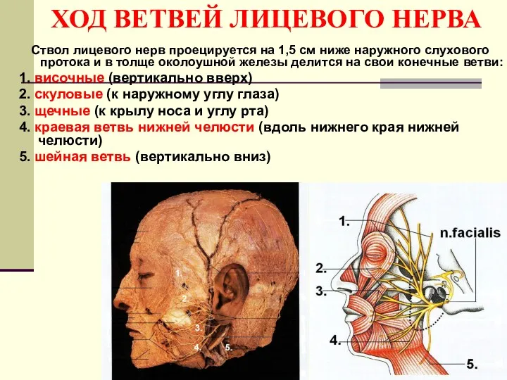 ХОД ВЕТВЕЙ ЛИЦЕВОГО НЕРВА Ствол лицевого нерв проецируется на 1,5