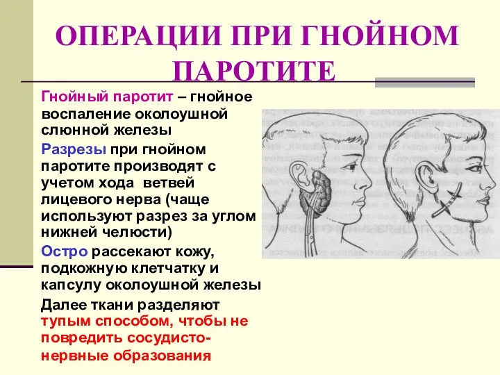 ОПЕРАЦИИ ПРИ ГНОЙНОМ ПАРОТИТЕ Гнойный паротит – гнойное воспаление околоушной