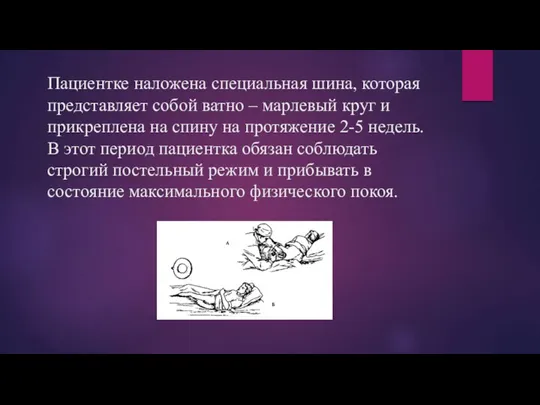 Пациентке наложена специальная шина, которая представляет собой ватно – марлевый