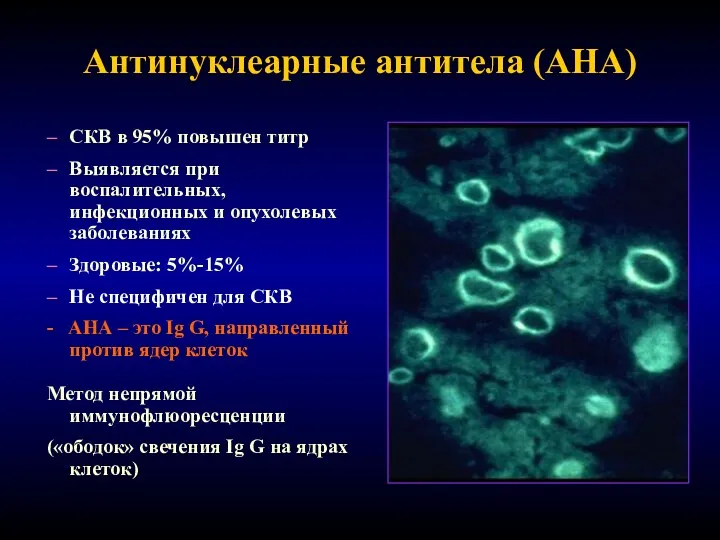 Антинуклеарные антитела (АНА) СКВ в 95% повышен титр Выявляется при