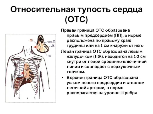 Относительная тупость сердца (ОТС) Правая граница ОТС образована правым предсердием