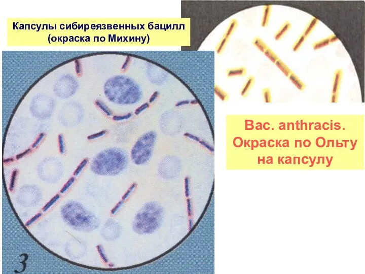 Bac. аnthracis. Окраска по Ольту на капсулу Капсулы сибиреязвенных бацилл (окраска по Михину)