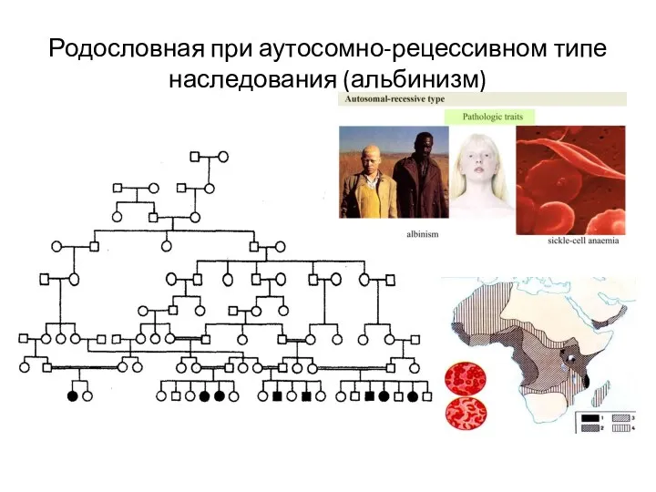 Родословная при аутосомно-рецессивном типе наследования (альбинизм)