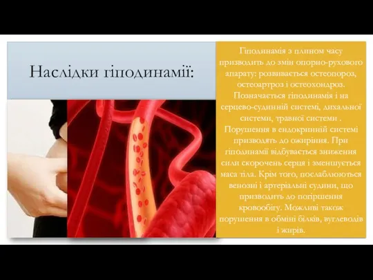 Наслідки гіподинамії: Гіподинамія з плином часу призводить до змін опорно-рухового